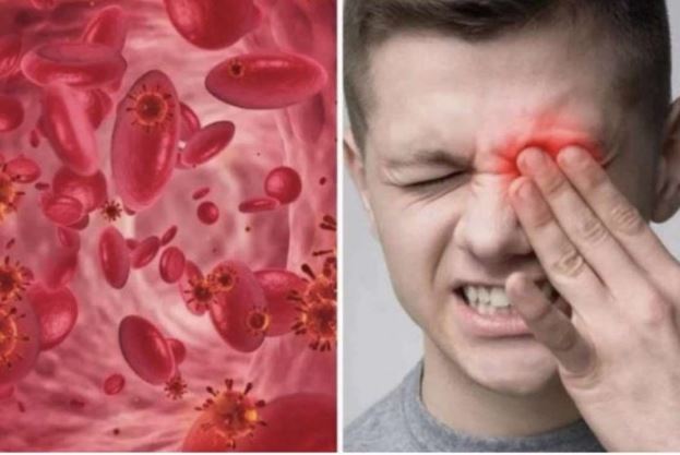 OVO SU SIMPTOMI NISKOG ŽELJEZA U KRVI: Tijelo vas upozorava JEDNIM SIMPTOMOM – ODMAH REAGUJTE - featured image OVO SU SIMPTOMI NISKOG ŽELJEZA U KRVI: Tijelo vas upozorava JEDNIM SIMPTOMOM – ODMAH REAGUJTE - featured image