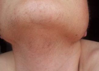 EVO ZAŠTO ŽENE IMAJU DLAKAVU BRADU! Ovo vam organizam govori! EVO ZAŠTO ŽENE IMAJU DLAKAVU BRADU! Ovo vam organizam govori! - featured image