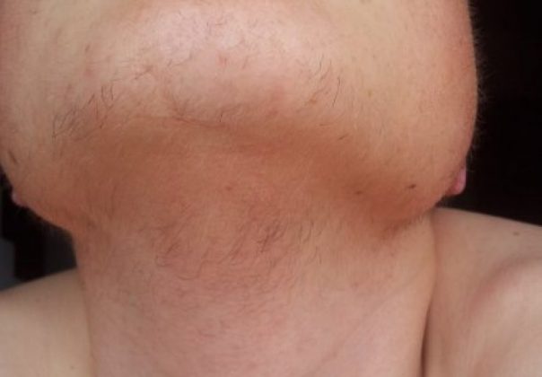 EVO ZAŠTO ŽENE IMAJU DLAKAVU BRADU! Ovo vam organizam govori! - featured image