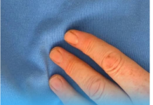 Doktorica upozorava: 90 posto srčanih udara povezano je s jednom jutarnjom navikom