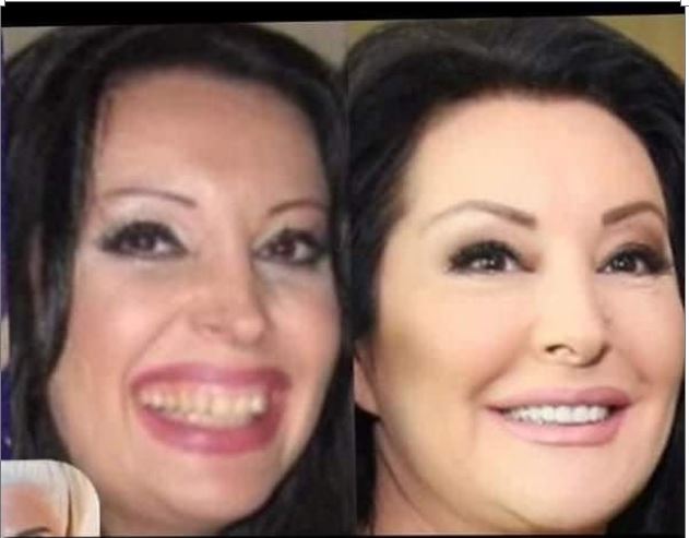 KAD SU SKUPILI PARE, URADILI SU ZUBE: POGLEDAJTE kako su izgledale domaće ličnosti PRIJE UMJETNIH ZUBA – CECA JE HIT (FOTO) - featured image