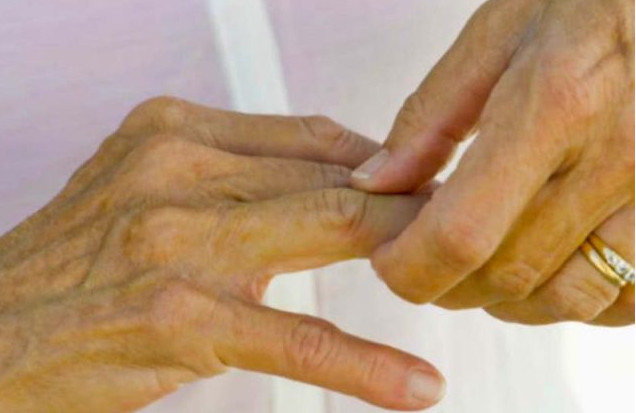 Kosti ne vole ovu hranu: Ako ovo jedete, bol je jači, artritis napreduje, zglobovi se troše… - featured image