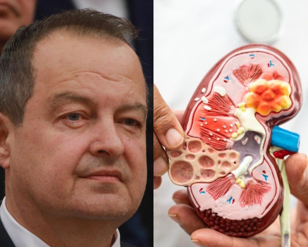 Ivica Dačić ne boluje samo od upale pluća, ovu bolest je ignorisao godinama, a tiho razara sve organe: Srbi je zanemaruju dok stanje ne postane opasno - featured image Ivica Dačić ne boluje samo od upale pluća, ovu bolest je ignorisao godinama, a tiho razara sve organe: Srbi je zanemaruju dok stanje ne postane opasno - featured image