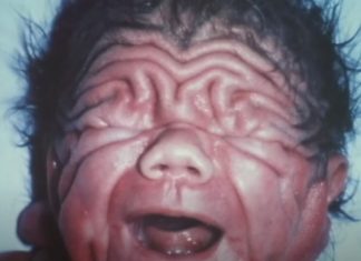 Na rođenju je izgledao kao Šar pej, ni lekari nisu mogli da objasne kako je to moguće: Ljudi tek ostanu u čudu kad vide kako izgleda 30 godina kasnije