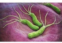 POVRĆKA KOJA UBIJA HELIKO BAKTERIJU, KISELINU I KARCINOM STOMAKA: Dovoljno je 70 grama dnevno! POVRĆKA KOJA UBIJA HELIKO BAKTERIJU, KISELINU I KARCINOM STOMAKA: Dovoljno je 70 grama dnevno! - featured image