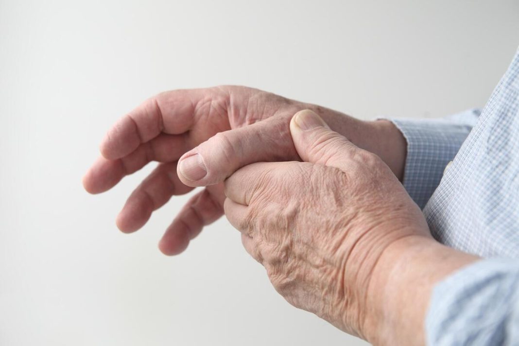 PROVERITE DOK NE BUDE KASNO! Fotografija ruke može otkriti POREMEĆAJ - stručnjaci apeluju, BOLEST RAZARA - featured image