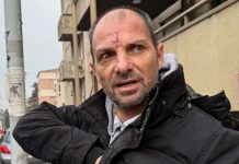 DOŽIVEO STRAVIČNO MUČENJE, JUČE NAPUSTIO BOLNICU Sin Snežane Đurišić o odnosu sa majkom i njenim partnerom Vanjom: “Imali smo sukob” DOŽIVEO STRAVIČNO MUČENJE, JUČE NAPUSTIO BOLNICU Sin Snežane Đurišić o odnosu sa majkom i njenim partnerom Vanjom: "Imali smo sukob" - featured image