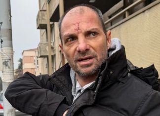 DOŽIVEO STRAVIČNO MUČENJE, JUČE NAPUSTIO BOLNICU Sin Snežane Đurišić o odnosu sa majkom i njenim partnerom Vanjom: “Imali smo sukob” DOŽIVEO STRAVIČNO MUČENJE, JUČE NAPUSTIO BOLNICU Sin Snežane Đurišić o odnosu sa majkom i njenim partnerom Vanjom: "Imali smo sukob" - featured image