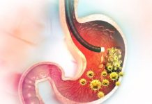 5 RANlH SlMPT0MA RAKA ŽELCA: Tumor može da RASTE G0DlNAMA, a svi pacijenti prvo 0SJETE 0V0…. 5 RANlH SlMPT0MA RAKA ŽELCA: Tumor može da RASTE G0DlNAMA, a svi pacijenti prvo 0SJETE 0V0…. - featured image