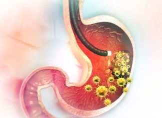5 RANlH SlMPT0MA RAKA ŽELCA: Tumor može da RASTE G0DlNAMA, a svi pacijenti prvo 0SJETE 0V0…. 5 RANlH SlMPT0MA RAKA ŽELCA: Tumor može da RASTE G0DlNAMA, a svi pacijenti prvo 0SJETE 0V0…. - featured image