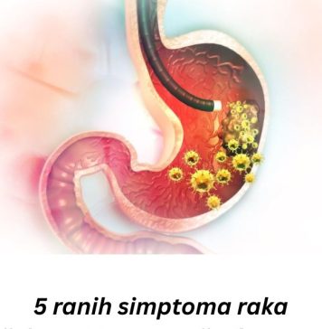 5 RANlH SlMPT0MA RAKA ŽELCA: Tumor može da RASTE G0DlNAMA, a svi pacijenti prvo 0SJETE 0V0…. 5 RANlH SlMPT0MA RAKA ŽELCA: Tumor može da RASTE G0DlNAMA, a svi pacijenti prvo 0SJETE 0V0…. - featured image