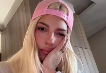 Izdvojila BRUKU za operaciju: Karleuša posetila najboljeg turskog hirurga, uskoro će izgledati mnogo mlađe