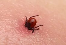 Sezona krpelja počela: Obratite pažnju na ovaj simptom Sezona krpelja počela: Obratite pažnju na ovaj simptom - featured image