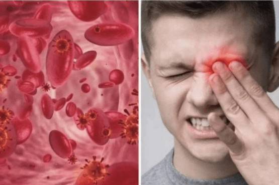 OVO SU SIMPTOMI NISKOG ŽELJEZA U KRVI: Tijelo vas upozorava JEDNIM SIMPTOMOM – ODMAH REAGUJTE - featured image