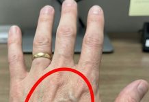 Ako imaš vidljive vene, to znači da si…😨😨‼️ Ako imaš vidljive vene, to znači da si…😨😨‼️ - featured image