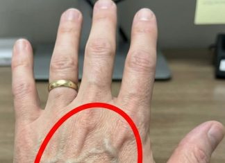 Ako imaš vidljive vene, to znači da si…😨😨‼️ Ako imaš vidljive vene, to znači da si…😨😨‼️ - featured image