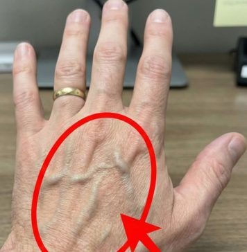 Ako imaš vidljive vene, to znači da si…😨😨‼️ Ako imaš vidljive vene, to znači da si…😨😨‼️ - featured image