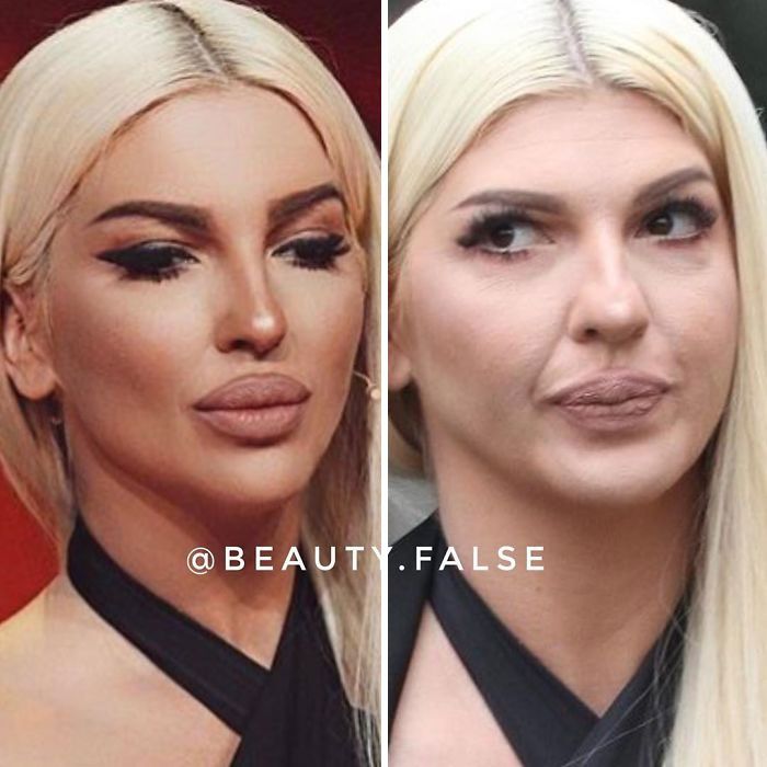 STVARNOST VS INSTAGRAM: Ovako zaista izgledaju pjevačice bez filtera i photoshopa! Ceca je najveće iznenađenje – POGLEDAJTE NJENU NEOBRAĐENU SLIKU (FOTO) - featured image