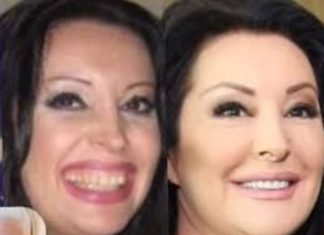 POGLEDAJTE kako su izgledale domaće ličnosti PRIJE UMJETNIH ZUBA – CECA JE HIT (FOTO) POGLEDAJTE kako su izgledale domaće ličnosti PRIJE UMJETNIH ZUBA – CECA JE HIT (FOTO) - featured image