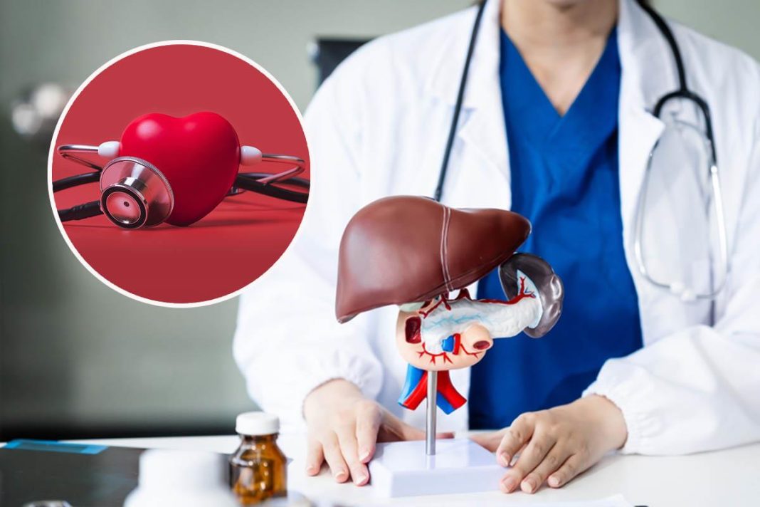 Masna jetra povećava rizik od srčanog udara: Novo istraživanje otkrilo zabrinjavajuću vezu - featured image