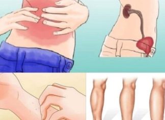 KAD SA BUBREZIMA NIJE SVE U REDU, TIJELO ŠALJE OVE SIGNALE: 6 Simptoma koje ne smijete ignorisati! KAD SA BUBREZIMA NIJE SVE U REDU, TIJELO ŠALJE OVE SIGNALE: 6 Simptoma koje ne smijete ignorisati! - featured image