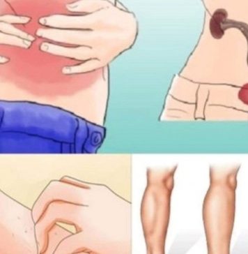 KAD SA BUBREZIMA NIJE SVE U REDU, TIJELO ŠALJE OVE SIGNALE: 6 Simptoma koje ne smijete ignorisati! KAD SA BUBREZIMA NIJE SVE U REDU, TIJELO ŠALJE OVE SIGNALE: 6 Simptoma koje ne smijete ignorisati! - featured image