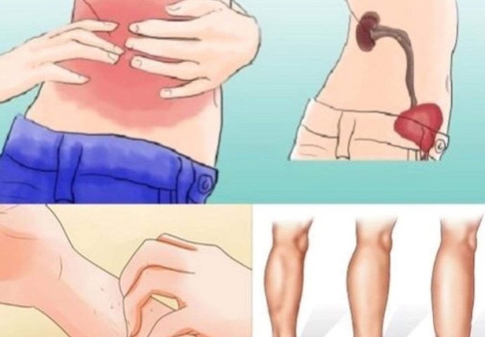 KAD SA BUBREZIMA NIJE SVE U REDU, TIJELO ŠALJE OVE SIGNALE: 6 Simptoma koje ne smijete ignorisati! - featured image KAD SA BUBREZIMA NIJE SVE U REDU, TIJELO ŠALJE OVE SIGNALE: 6 Simptoma koje ne smijete ignorisati! - featured image
