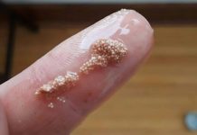 Bele grudvice u jajetu: šta to zaista znači i da li treba da brinete? Bele grudvice u jajetu: šta to zaista znači i da li treba da brinete? - featured image