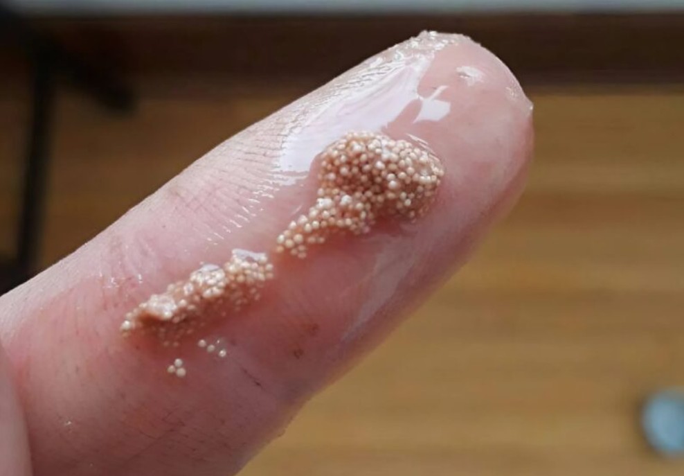 Bele grudvice u jajetu: šta to zaista znači i da li treba da brinete? - featured image Bele grudvice u jajetu: šta to zaista znači i da li treba da brinete? - featured image