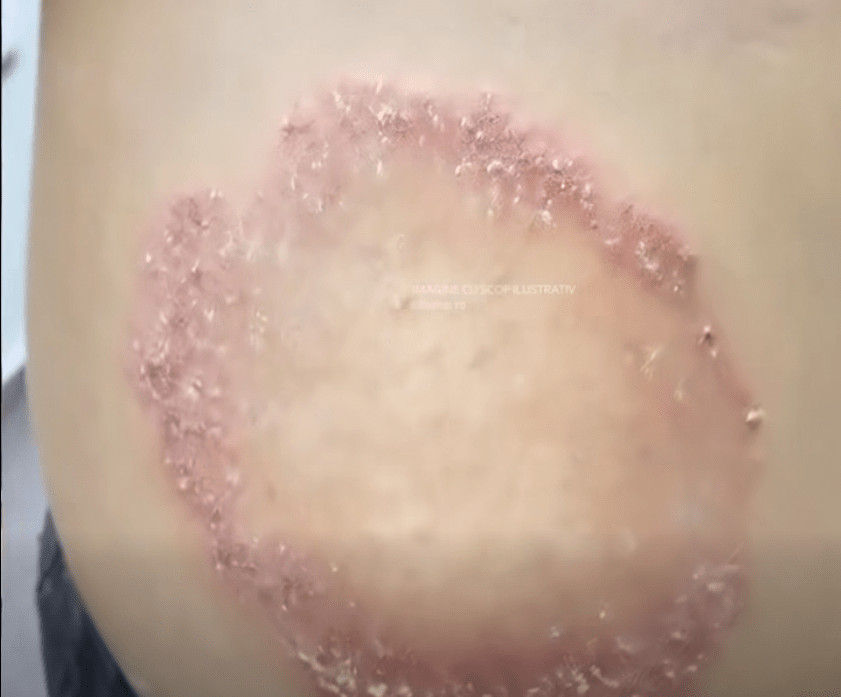 Ovo su znakovi da vam stres utiče na život – i šta možete da uradite povodom toga - featured image Ovo su znakovi da vam stres utiče na život – i šta možete da uradite povodom toga - featured image