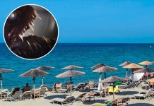 Dečak iz Srbije zgazio otrovno stvorenje na plaži u Grčkoj: “Toliko boli i brzo otiče da ne mogu da vam opišem” Dečak iz Srbije zgazio otrovno stvorenje na plaži u Grčkoj: “Toliko boli i brzo otiče da ne mogu da vam opišem” - featured image