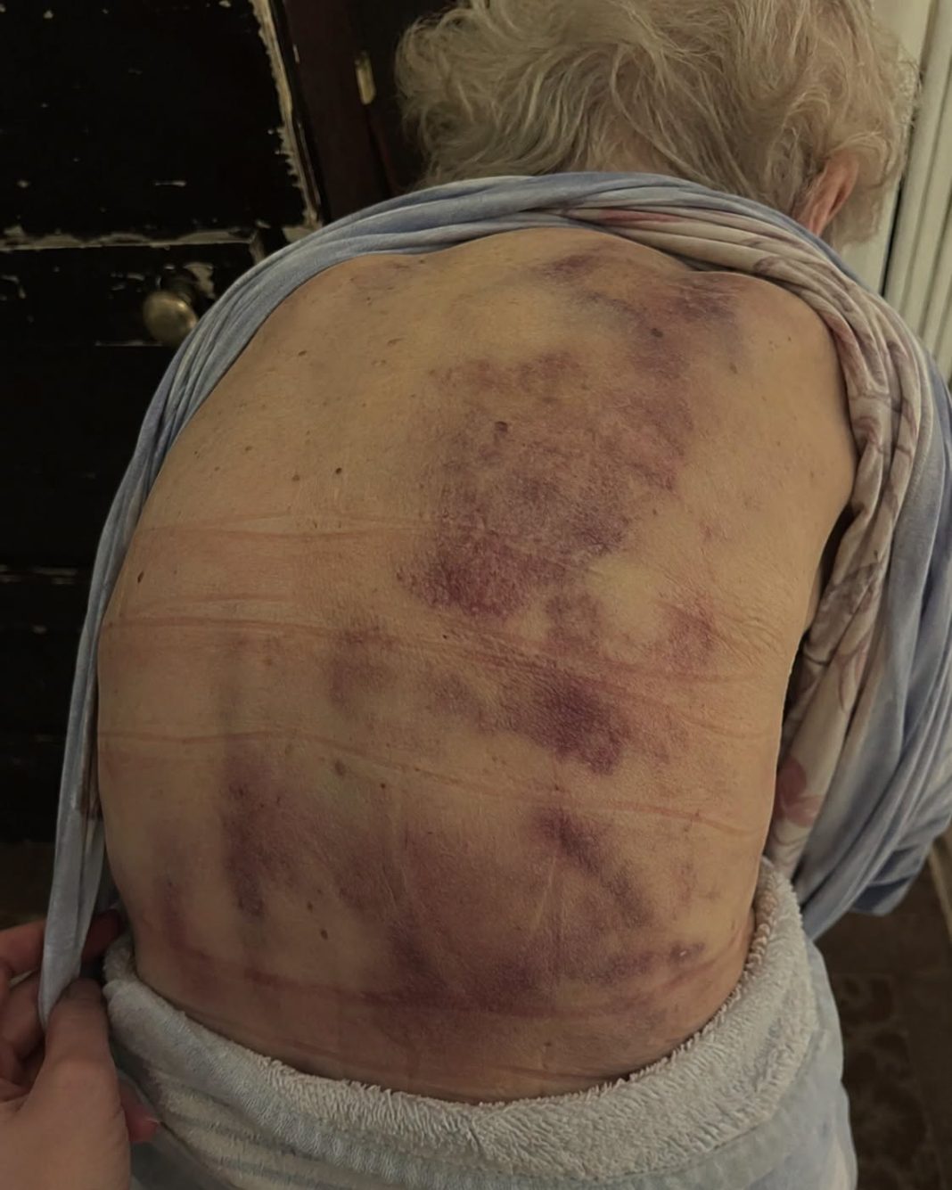 Vratila sam se kući kako bih pomogla svojoj starijoj majci da se okupa. Čim sam posegnula prema njoj, trgnula se kao da ću je udariti. - featured image Vratila sam se kući kako bih pomogla svojoj starijoj majci da se okupa. Čim sam posegnula prema njoj, trgnula se kao da ću je udariti. - featured image