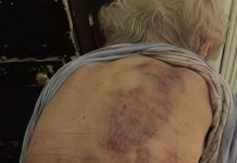 Vratila sam se kući kako bih pomogla svojoj starijoj majci da se okupa. Čim sam posegnula prema njoj, trgnula se kao da ću je udariti. Vratila sam se kući kako bih pomogla svojoj starijoj majci da se okupa. Čim sam posegnula prema njoj, trgnula se kao da ću je udariti. - featured image