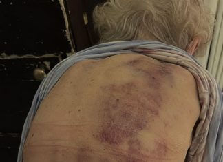 Vratila sam se kući kako bih pomogla svojoj starijoj majci da se okupa. Čim sam posegnula prema njoj, trgnula se kao da ću je udariti. Vratila sam se kući kako bih pomogla svojoj starijoj majci da se okupa. Čim sam posegnula prema njoj, trgnula se kao da ću je udariti. - featured image