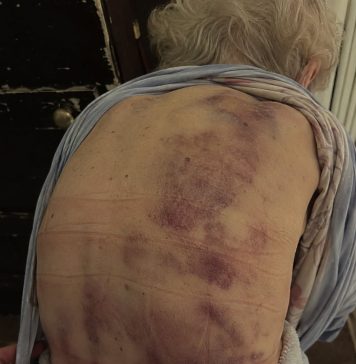 Vratila sam se kući kako bih pomogla svojoj starijoj majci da se okupa. Čim sam posegnula prema njoj, trgnula se kao da ću je udariti. Vratila sam se kući kako bih pomogla svojoj starijoj majci da se okupa. Čim sam posegnula prema njoj, trgnula se kao da ću je udariti. - featured image