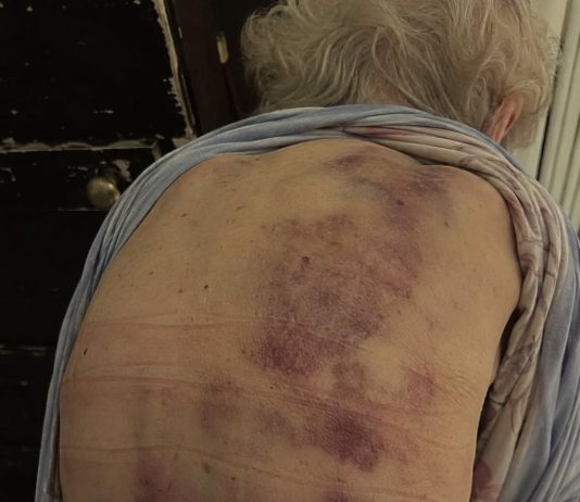 Vratila sam se kući kako bih pomogla svojoj starijoj majci da se okupa. Čim sam posegnula prema njoj, trgnula se kao da ću je udariti. Vratila sam se kući kako bih pomogla svojoj starijoj majci da se okupa. Čim sam posegnula prema njoj, trgnula se kao da ću je udariti. - featured image