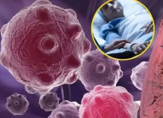 8 namirnica koje smanjuju upale i jačaju imunitet — savršen početak dana 8 namirnica koje smanjuju upale i jačaju imunitet — savršen početak dana - featured image