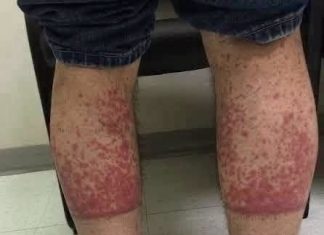 OVO SU POSLJEDICE SPAVANJA SA… ŠTA SE ZAISTA DEŠAVA POSLIJE…. OVO SU POSLJEDICE SPAVANJA SA… ŠTA SE ZAISTA DEŠAVA POSLIJE…. - featured image