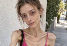 😨💔👉 Sa 18 godina svakoga sam dana gubila na težini, misleći da napokon postajem “savršena”… Ali zapravo sam polako gubila samu sebe. 😨💔👉 Sa 18 godina svakoga sam dana gubila na težini, misleći da napokon postajem “savršena”… Ali zapravo sam polako gubila samu sebe. - featured image