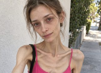 😨💔👉 Sa 18 godina svakoga sam dana gubila na težini, misleći da napokon postajem “savršena”… Ali zapravo sam polako gubila samu sebe. 😨💔👉 Sa 18 godina svakoga sam dana gubila na težini, misleći da napokon postajem “savršena”… Ali zapravo sam polako gubila samu sebe. - featured image