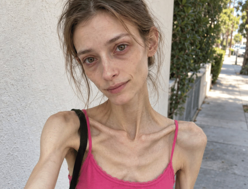 😨💔👉 Sa 18 godina svakoga sam dana gubila na težini, misleći da napokon postajem “savršena”… Ali zapravo sam polako gubila samu sebe. - featured image