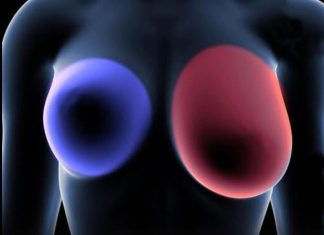 Rani znaci na dojkama koje bi svaka žena starija od 60 godina trebala poznavati Rani znaci na dojkama koje bi svaka žena starija od 60 godina trebala poznavati - featured image