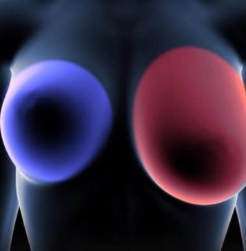 Rani znaci na dojkama koje bi svaka žena starija od 60 godina trebala poznavati Rani znaci na dojkama koje bi svaka žena starija od 60 godina trebala poznavati - featured image